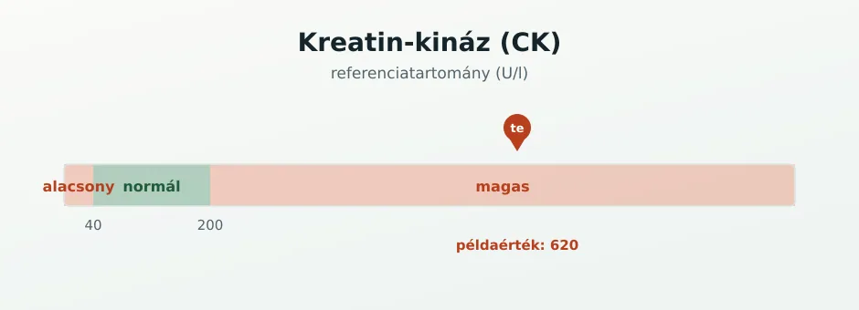CK referenciasáv U/l-ben