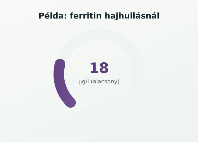 Ferritin gauge hajhullásnál