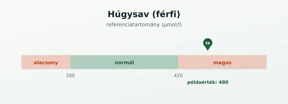 Húgysav referenciasáv µmol/l-ben