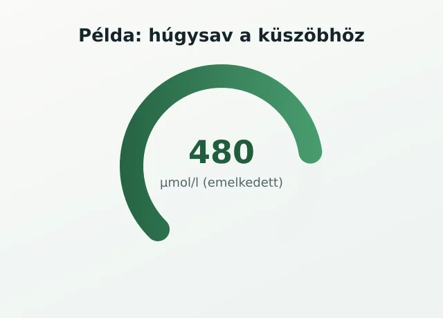 Húgysav gauge
