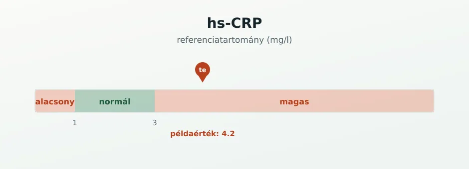 hs-CRP referenciasáv mg/l-ben