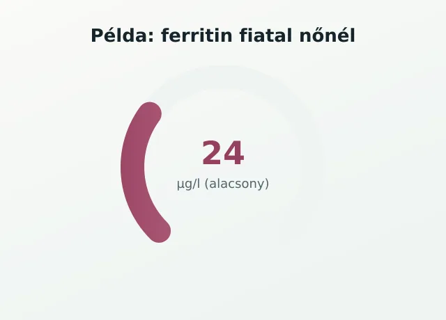 Ferritin gauge nőnél