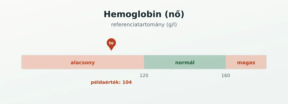 Hemoglobin referenciasáv g/l-ben